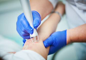 Laser cosmetic surgery and skin resurfacing in dermatology