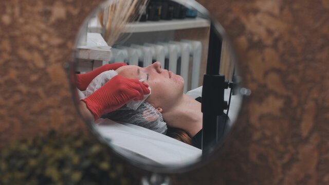 Wipe the mask off the face of a girl with problematic koja with cotton pads.