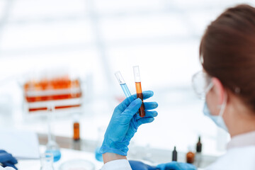 rear view . test tube in hands of the laboratory employee.