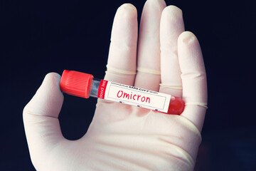 Doctor with a positive blood sample for the new variant detected of the african coronavirus strain...