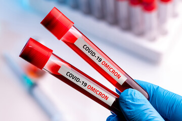 Doctor with blood sample of Covid-19 Omicron B.1.1.529 Variant and general data of covid-19...