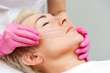 Thread lifting procediure. Professional cosmetologist in pink medical gloves holding needles near...