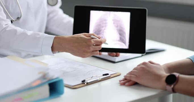 Doctor showing xray image of lungs to patient on digital tablet 4k movie slow motion