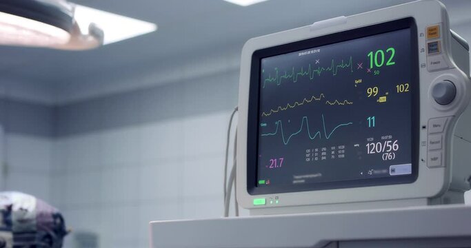 Artificial lung ventilation device. A heart monitor in the clinic. Heart rate monitor during surgery in the surgical department. Life support equipment. SARS-COV-2 COVID-19 Coronavirus