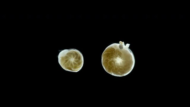 Foraminifera under a microscope, class Rotaliata, possibly order Rotaliida. Protista have a mineral shell. Shows movement of pseudopodia with which she captures food