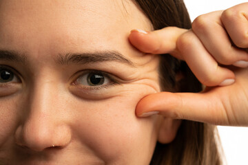 young woman showing her eye wrinkles with her fingers