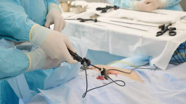 Laparoscopic surgery in hospital. Modern medical equipment in operating room. Surgical intervention in abdominal cavity for treatment or elimination of pathology, careful precise movements of doctor