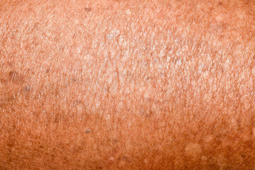 Fototapeta premium brown human skin texture close-up abstract skin background