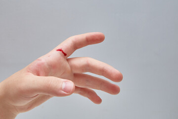 Blood on the hand. A knife cut. close-up. Copy space, blue background.