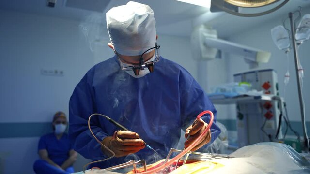 Male neurosurgeon leading an operation. Surgeon holding and applying special tools in the operation and smoke comes from the patient&rsquo;s wound. Assistant hands over surgical forceps to the doctor.