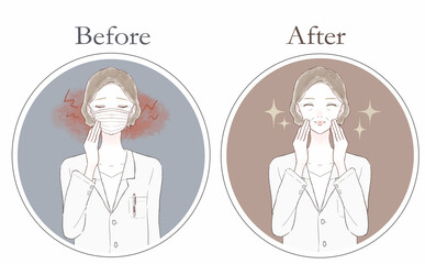 マスク着用による摩擦・炎症に悩む中年の女性医師のビフォーアフター