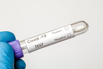 Fototapeta premium blood test with the label Covid-19 DELTA Variant.
