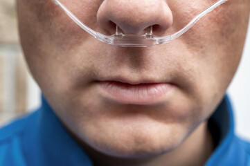 Junger Mann mit Sauerstoffbrille zur Beatmung mit Sauerstoff