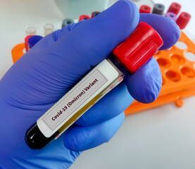Scientist hold test tube with blood for Covid-19 Omicron Variant test. Omicron b.1.1.529