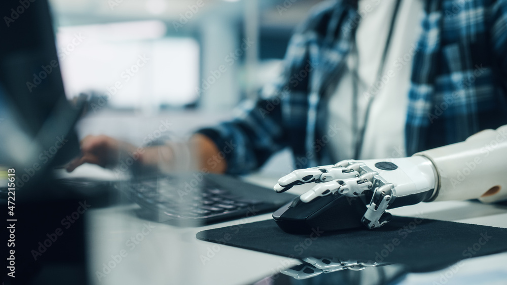 Poster diverse body positive office: woman with disability using prosthetic arm to work on computer. profes