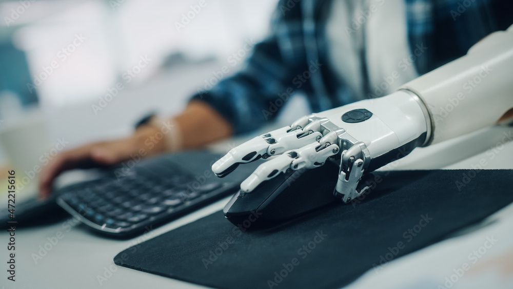 Poster Inclusive Office: Person with Disability Using Prosthetic Arm to Work on Computer. Professional with Advanced Myoelectric Bionic Limb to Control Mouse. Shot with Focus on Hands with Dutch Angle