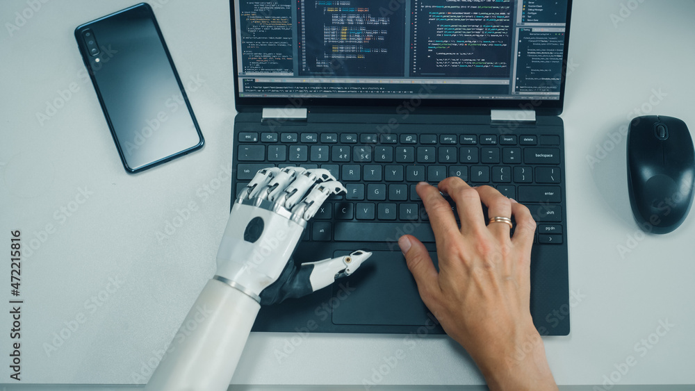 Poster Top Down View: Professional Programmer with Disability Using Prosthetic Arm to Work on Laptop Computer. Specialist Swift and Natural Use of Myoelectric Bionic Hand To Type Code for Software