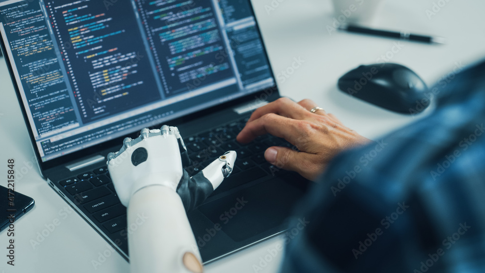 Aufkleber Over Shoulder Hands Close-up: Programmer With Disability Using Prosthetic Arm to Work on Laptop Computer. Specialist Swift and Natural Use of Myoelectric Bionic Hand To Type Code for Software