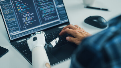 Over Shoulder Hands Close-up: Programmer With Disability Using Prosthetic Arm to Work on Laptop...