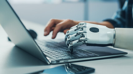 Close-up on Hands: Person with Disability Using Prosthetic Arm to Work on Laptop Computer....