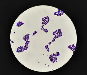 Culture colonies gram stained Microscopic 100x show Candida spp, fungi, emerging multidrug fungus....