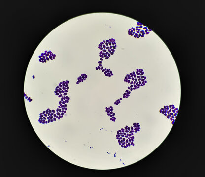 Culture colonies gram stained Microscopic 100x show Candida spp, fungi, emerging multidrug fungus. Candida albicans, C. auris and other yeast fungi. Close up micrograph. laboratory analysis
