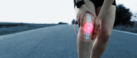  Sporty woman who suffered a knee accident during the run.  
Joint  problems and tendon inflammation. - obrazy, fototapety, plakaty