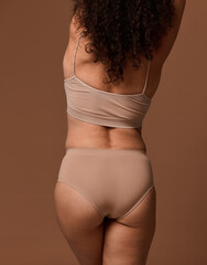 Rear view of an unrecognizable woman in beige underwear with skin problems and overweight....