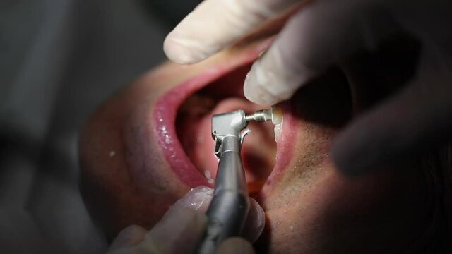 Person cleaning mouth at dentist clinic