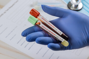 Tube containing a blood sample for COVID-19 that has tested positive of new version Omicron of...
