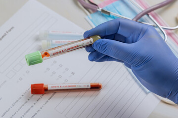 Medical professionals in the laboratory with blood samples for new version Omicron Covid-19...