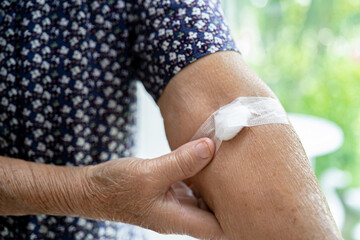 Asian senior or elderly old lady woman patient show cotton wool stop bleeding, after blood drawing testing for annually physical health check up to check cholesterol, blood pressure, and sugar level.