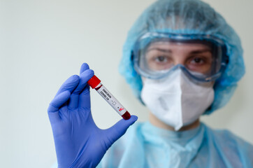 Medical laboratory assistant holding test tube with positive Omicron COVID-19 test blood sample.