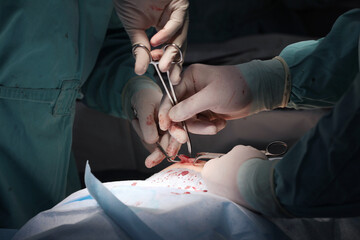 The surgeon sutures after laparoscopic surgery. Completion of the operation to remove the inguinal...