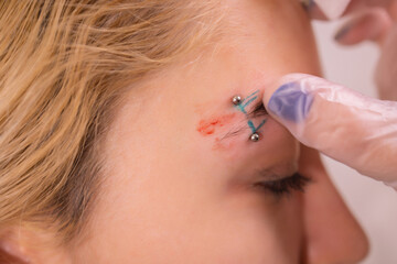Professional placing the jewel of piercing on the temple on the head with ball. Tragus type.