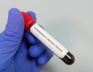 Fototapeta premium Molecular biologist hold blood sample for Coronavirus Omicron Variant test. Omicron b.1.1.529. african new covid-19 variant