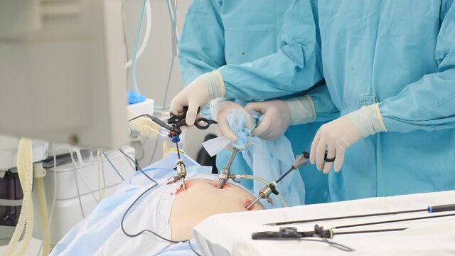 Operating room, team of surgeons performing laparoscopic intervention. Modern medicine, medical equipment in hospital. Laparoscope tools and hands. Doctors use endo-instruments and video cameras. 4 k