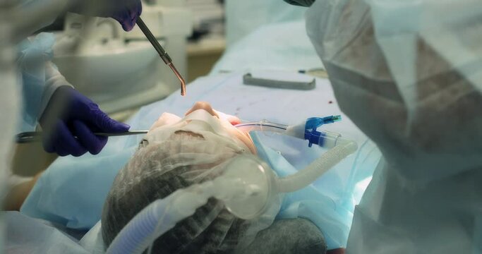 The surgeon and the assistant remove the wisdom teeth of the patient under general anesthesia in the department of surgical dentistry. Tooth extraction. Bone grafting, installation of dental implants