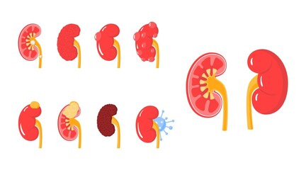 Kidney diseases concept in flat style, vector