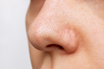 Close-up of a woman's nose with blackheads or black dots isolated on a white background. Acne problem, comedones. Enlarged pores on the face. Cosmetology dermatology concept - obrazy, fototapety, plakaty