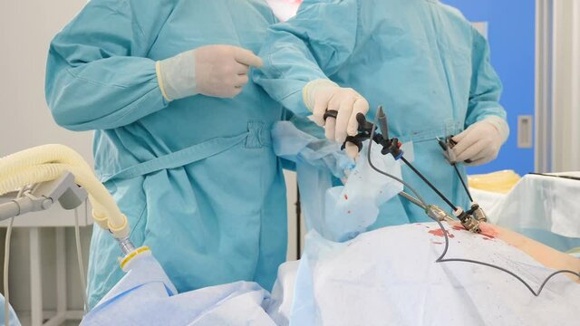 Laparoscopic instruments in action during abdomen surgery. Close-up shot. Team of doctors cooperating while performing laparoscopic intervention in hospital operating room. Laparoscopy in modern