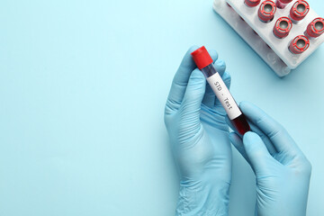 Scientist holding tube with blood sample and label STD Test on light blue background, top view....