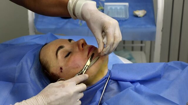Facelift with spiral threads for a girl in a beauty salon