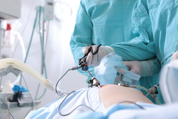 Medical instruments in the hands of doctors. Laparoscopic surgery. Modern medical equipment....