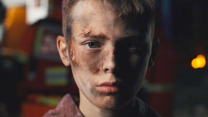 Teenager with dirty face looking at camera while standing near ambulance van after accident at night