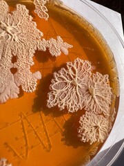 closeup photo of bacterial colonies grown on yello agar media
