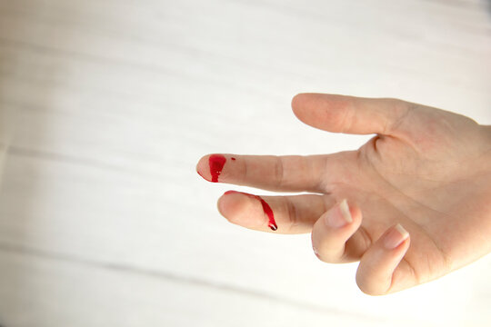 hand injury with blood, blood wound cut top view, copy space, medical concept needs stitches