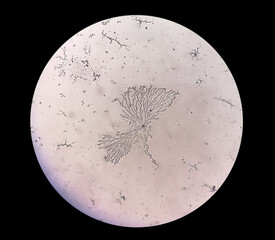 Microscopic view of dermatophytes. fungus test. 40X. Diagnosis for fungal infection.