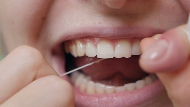 Close-up shot of a woman flossing her teeth while removing leftover food from the interdental space