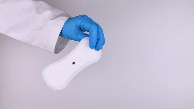 Hypomenorrhea. The woman shows a gynecological pad with a small drop of blood on it. Concept of small amounts during scanty menstruation. Complaints of pain and strange cycle. Diseases in gynecology